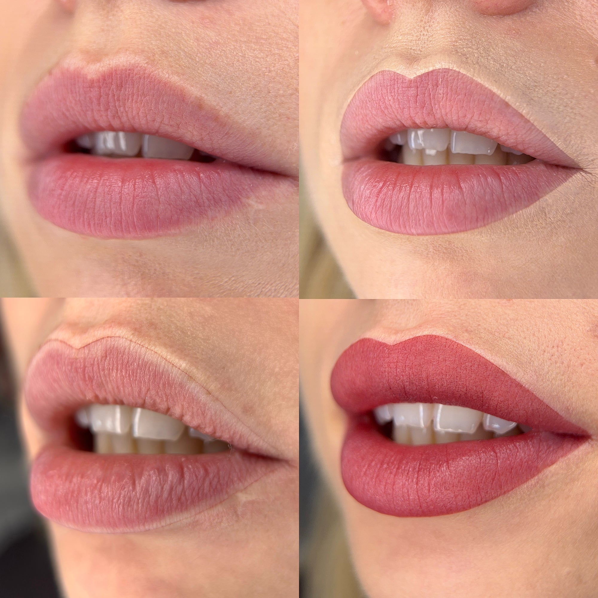 Comparativa de labios nude recién micropigmentados justo después del tratamiento de PMU, mostrando distintos objetivos de cicatrización y respuestas del tejido