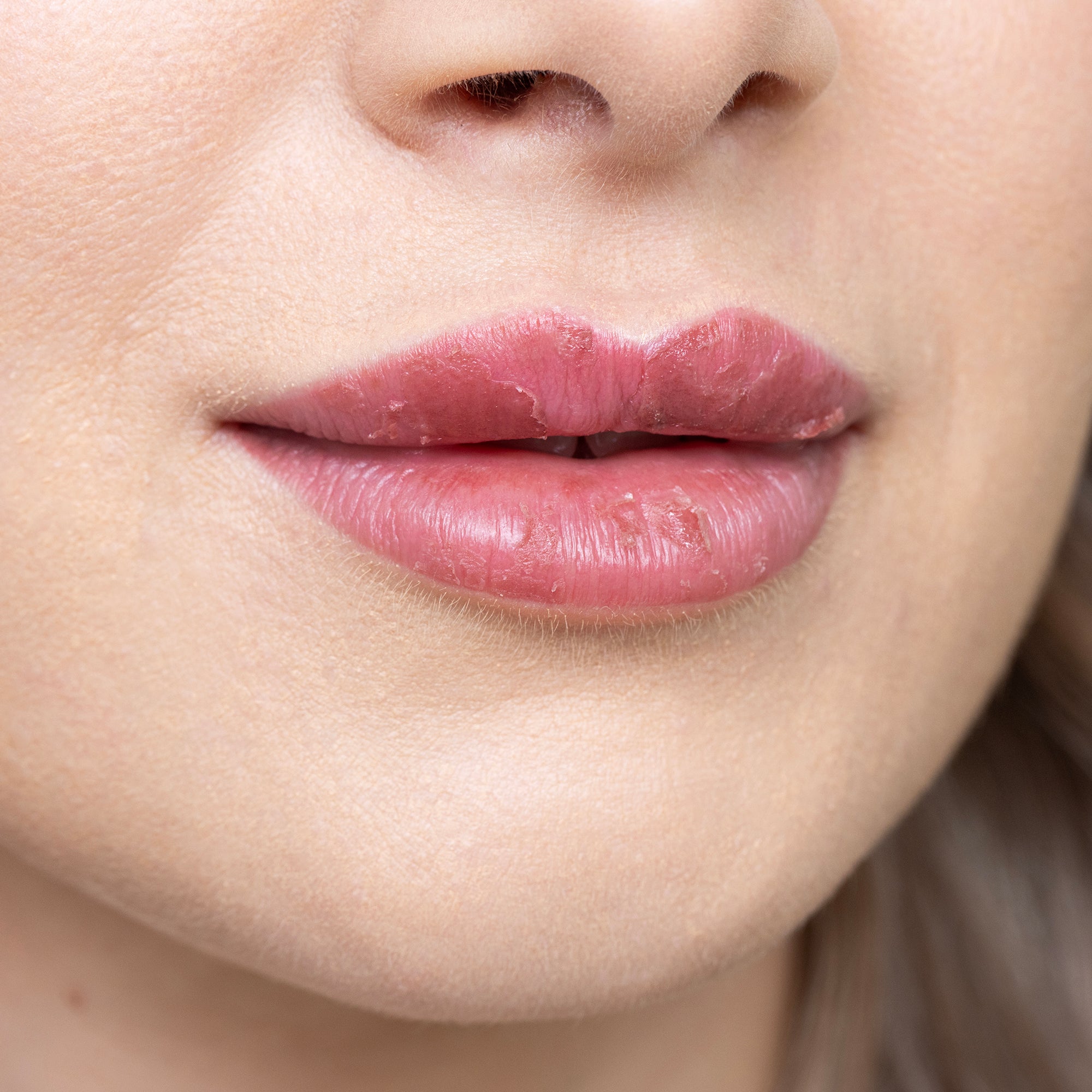 Labios en proceso de cicatrización tras una micropigmentación lip blush